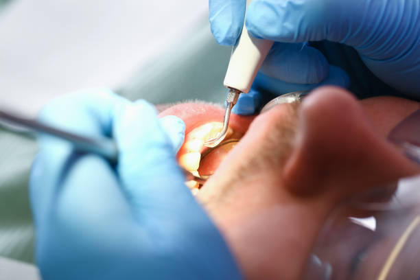 Best Emergency Dentist for Knocked-Out Tooth in Salem, OH